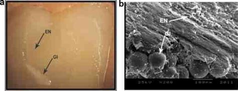 A B Stereo Microscope And SEM Images Of Enamel Side Of Debonded