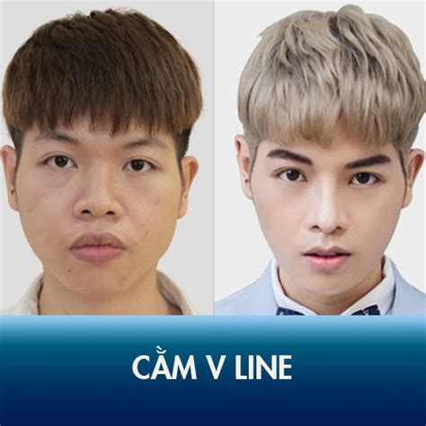 Cập nhật nhiều hơn 99 mặt v line nam để tóc gì siêu hot iedunet edu vn