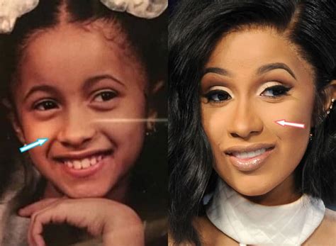 Cardi B Plastic Surgery Revealed Before And After Photos 2021