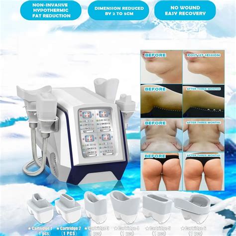 Fat Freezer Body Sculpting Cryolipolisis Cryotherapy System Body