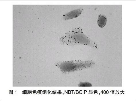 caveolin1脚手架样结构域多肽对HEp2细胞迁移和侵袭能力的影响 参考网