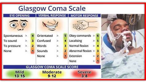 Glasgow Coma Scale Made Easy Youtube Glasgow Coma Scale Healthcare Sexiz Pix