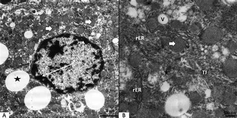 A Electron Micrograph Of Ultrathin Section Of The Group Received Vit