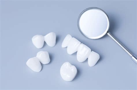 Dental Implant Or Bridge Whats Right For You Now Dental Implants