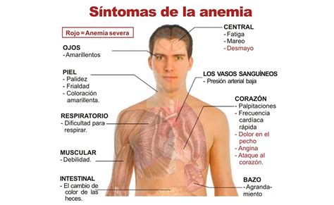 Tips Anemia Verfarma