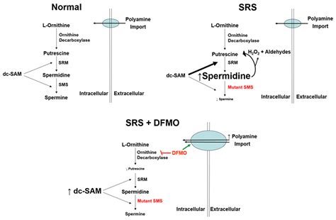 Rebalancing polyamine levels to treat Snyder–Robinson syndrome | EMBO ... 