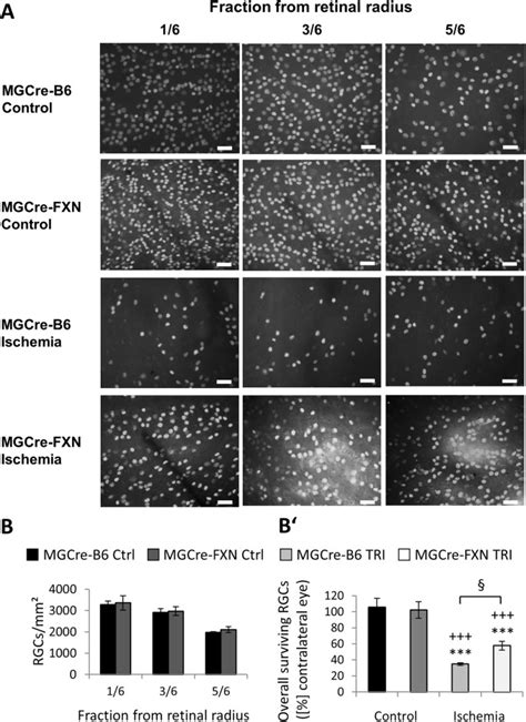 Frataxin Overexpression In Müller Cells Protects Retinal Ganglion Cells