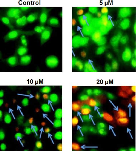 Globularifolin Triggered Apoptosis In Sacc Cells As Indicated By