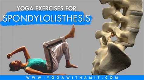 Best Yoga Exercises for Spondylolisthesis - YOGA WITH AMIT