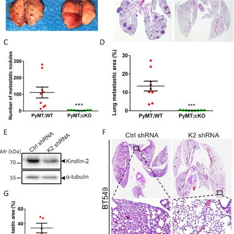 Loss Of Kindlin 2 Inhibits Breast Tumor Metastasis In Vivo A