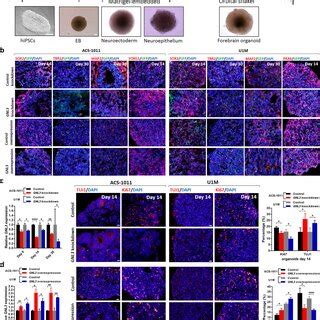 Effects Of GNL3 Knockdown And Overexpression In Human Forebrain