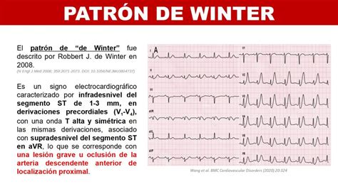 CardioTruco patrón de Winter Cardioprimaria Ferrol