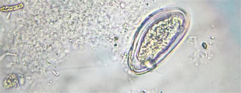 Pinworm Under Microscope