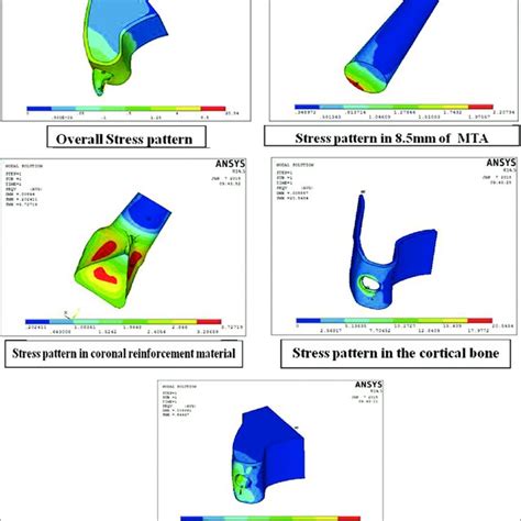 Stress Concentration In Individual Model Download Scientific Diagram