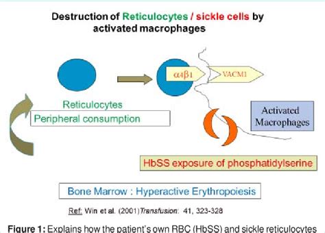 Figure From Hyperhaemolysis Syndrome In Sickle Cell Disease