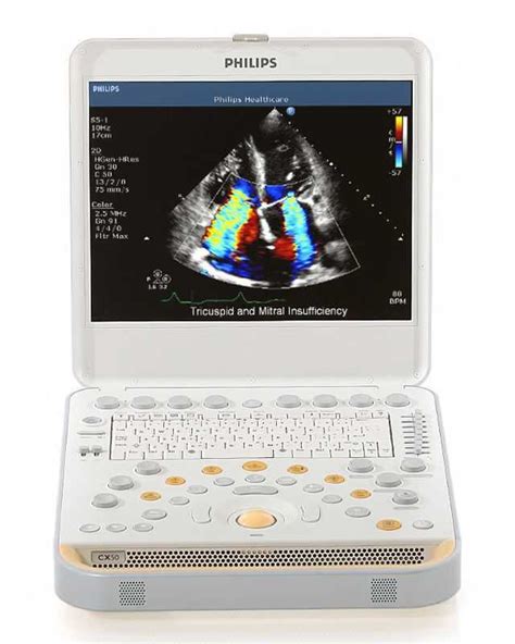 Philips Cx50 General Imaging Ultrasound System Marcroft Medical