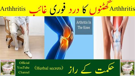 Ghutno Ke Dard Ka Ilaj Knee Pain Treatment In Urdu Natural Home