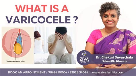 Varicocele Symptoms What Is Varicocele Male Infertility Dr