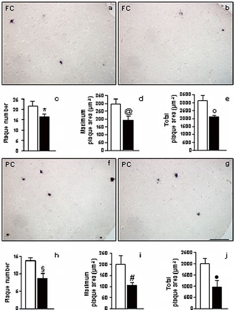 A β plaque burden in CMC treated Tg a f and CQ treated Tg b g mice