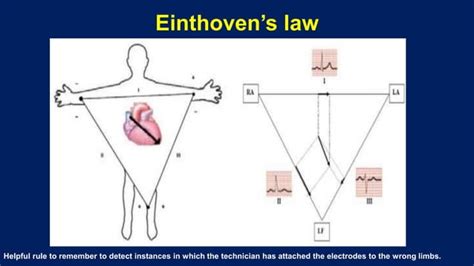 Basic Electrocardiography Ppt