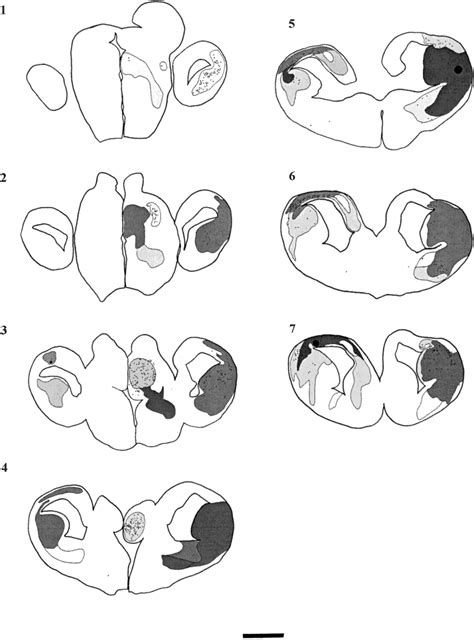 The Distribution Of Backlabelled Cells And The Pattern Of Fibre