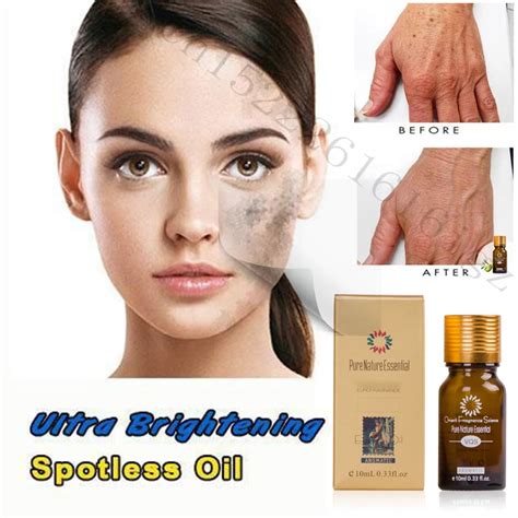 Ultra Brightening Spotless Oil Dark Spots Removal Age Spots Hyper