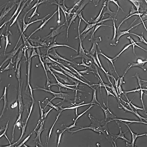 Human Bone Marrow Derived Mononuclear Cells Kosheeka