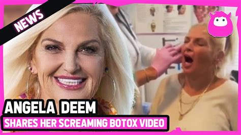 Angela Deem Shares Video Painfully Getting Botox Youtube