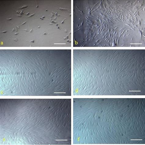 The morphology of isolated cells from bone marrow presented features of... | Download Scientific ...