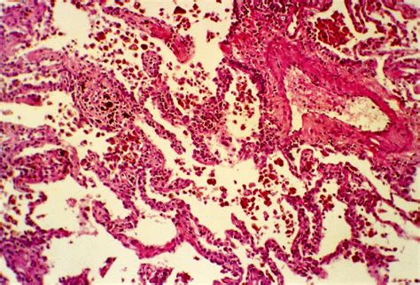 Light Microscopy Lung Parenchyma A Functional Unit Consisting Of A