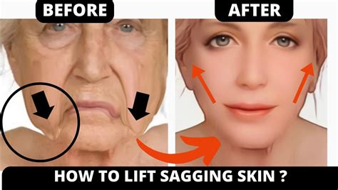 🛑 Anti Aging Face Lifting Exercises For Sagging Skin Jowls Laugh