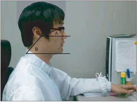 A Is The Angle Between The Tragus Of The Ear The Lateral Canthus Of