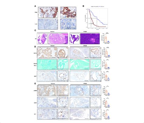 Inhibition Of Itga Prevents Pdac Growth A Immunohistochemical