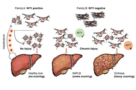 October Liver Cells News And Features University Of Bristol