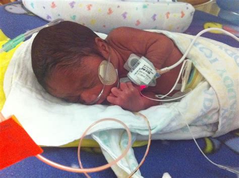 I Had My Baby At 28 Weekshe Is 2 Weeks Old Today Babycenter