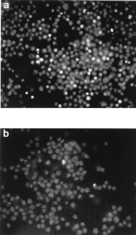 Quantification Of Live Necrotic And Apoptotic Cells By Fluorescence