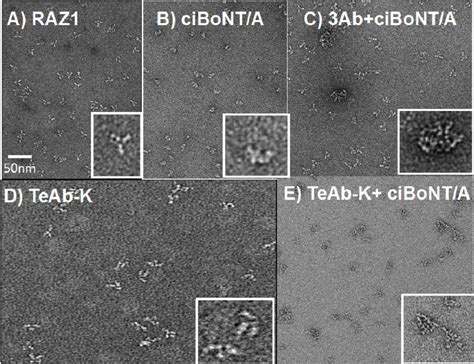 Negative Stain Electron Microscopy Ns Em Images Of Teab K Immune