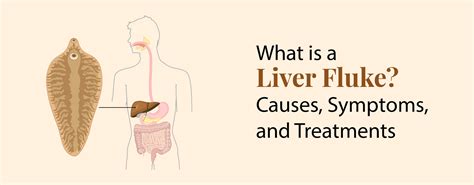 What Is A Liver Fluke Causes Symptoms And Treatments