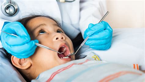 La Oms Alerta Sobre La Caries Dental Infantil Es Prevenible