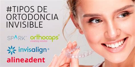 Precio Ortodoncia Invisalign Toda La Info