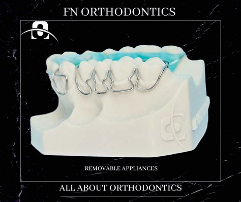 Removable Appliances Fn Orthodontics