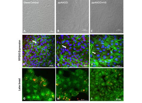 Morphology Of Arpe Cells On Glass Ppaaod And Ppaaod Hs Coverslip