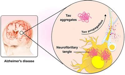 Frontiers The Application Of Nanotechnology In Treatment Of Alzheimer