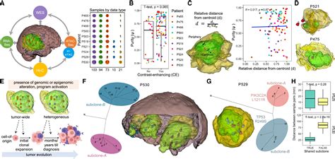 Glioblastoma Evolution And Heterogeneity From A D Whole Tumor