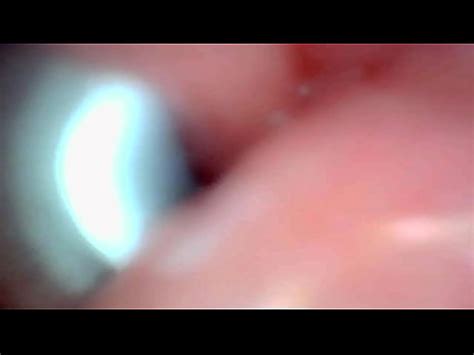 Endoscope Camera Captures Moment Of Male Ejaculation Xvideos