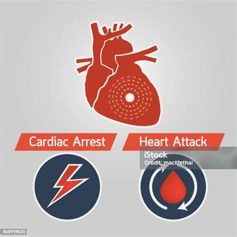 心臟驟停與心臟病發作向量圖示向量圖形及更多人體構造圖片 人體構造 健保和醫療 動脈 血管 Istock