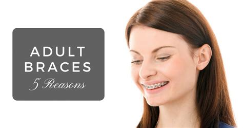 5 Reasons To Get Braces As An Adult Solas Orthodontics