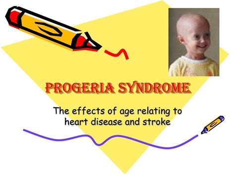 Ppt Progeria Syndrome Powerpoint Presentation Free Download Id4203829