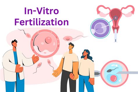 What Is In Vitro Fertilization Ivf 2024 Norvic Hospital