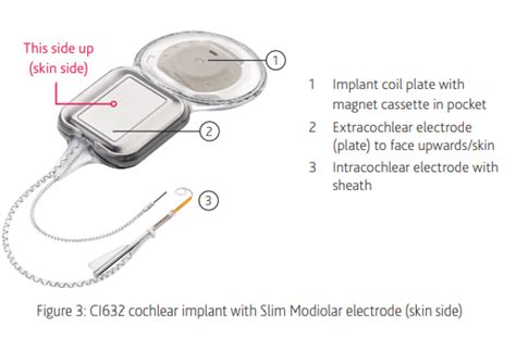 MRI Compatible Cochlear Implant - Good Design